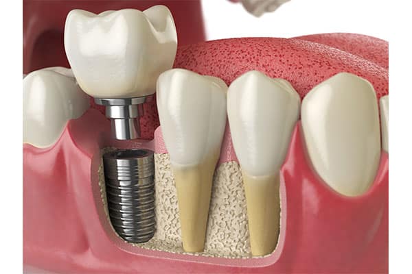 Prosthodontics